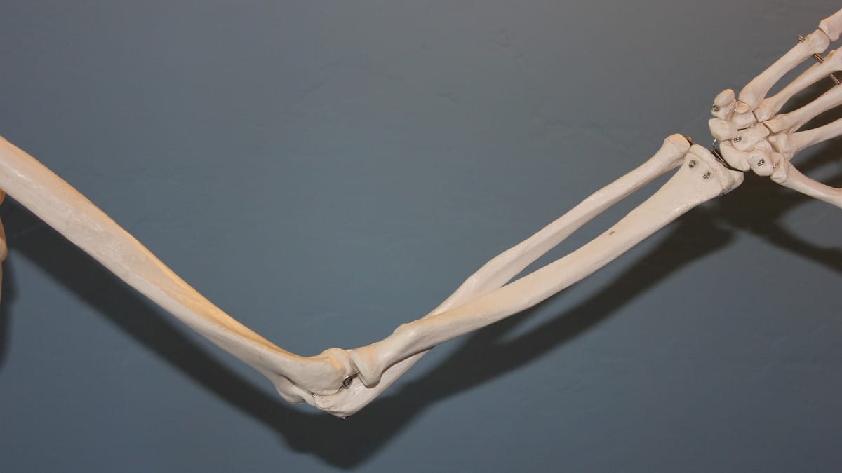 Explaining a fractured elbow